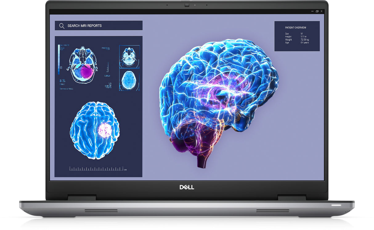 DELL Laptop Precision 7680 16" 3840x2400 Táctil, Intel Core i9-13950HX, NVIDIA RTX 2000 Ada, 32GB, 1TB SSD, Windows 11 Pro, Inglés Laptop Estación de trabajo móvil Gris Concha Negocios
